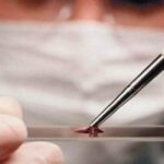 Аналіз крові: які показники говорять про те, що у вас проблеми зі здоров’ям