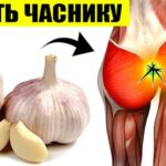 Часник: 8 дивовижних фактів про користь часнику
