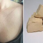 Дріжджова маска для усунення зморшок на шиї та грудях