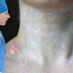 5 способів зберегти красиву шию, не вдаючись до хірургії