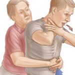 Хват Геймліха врятує вам життя — як його правильно виконувати