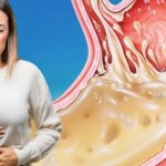 Як позбутися печії: 6 продуктів-вогнегасників Точно перевірено.