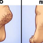 Ось 9 домашніх засобів, щоб усунути тріщини на п’ятах і зробити свої ніжки ще гарнішими