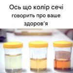Що колір сечі говорить про ваше здоров’я